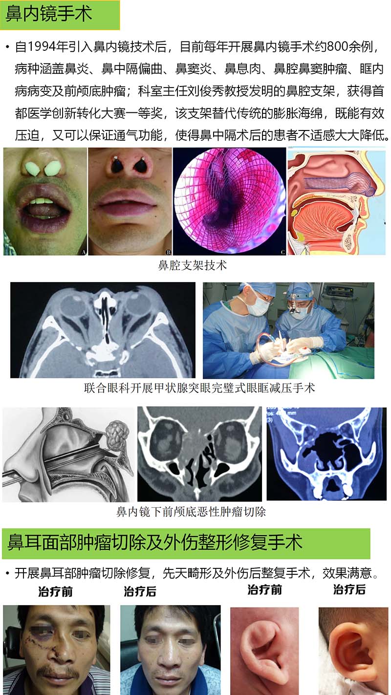 鼻息肉最新手术治疗步骤详解，权威指南
